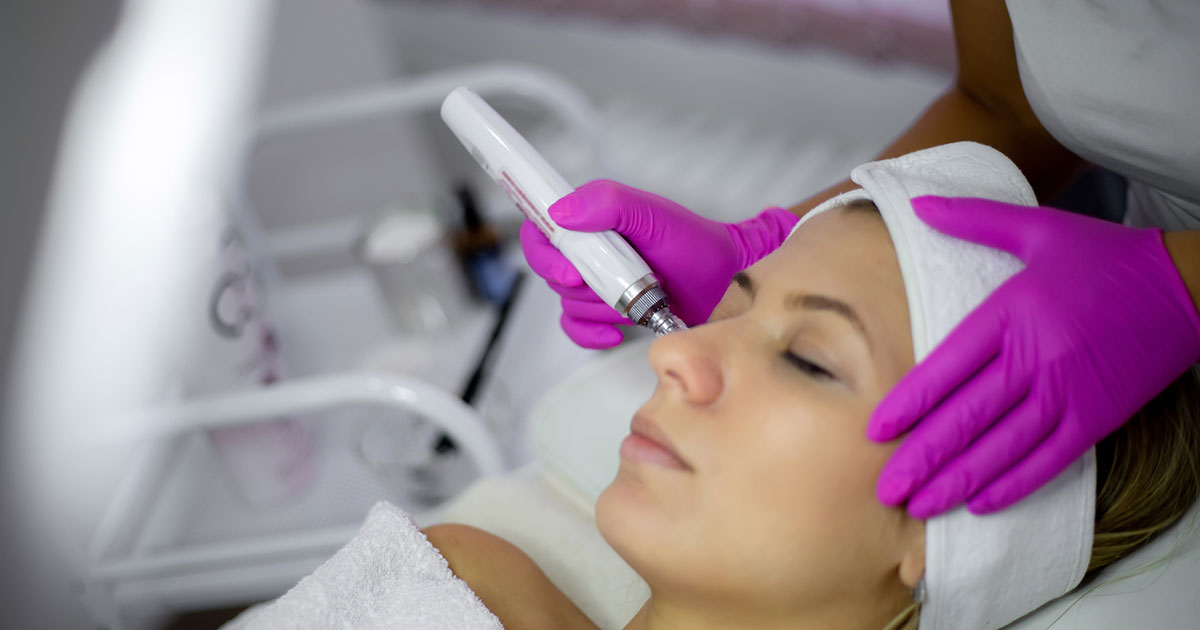 Is Microneedling for You?