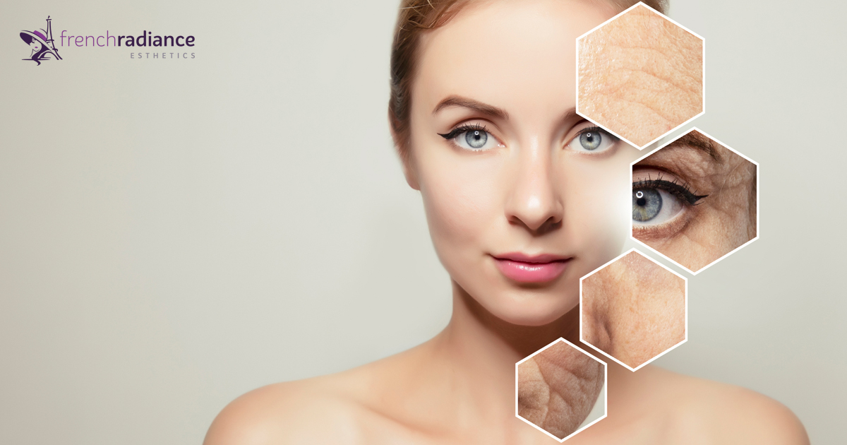 An Introduction to the World of Microneedling