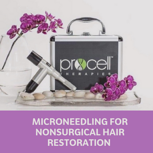Hair Restoration Using Procell Pure Stem Cells
