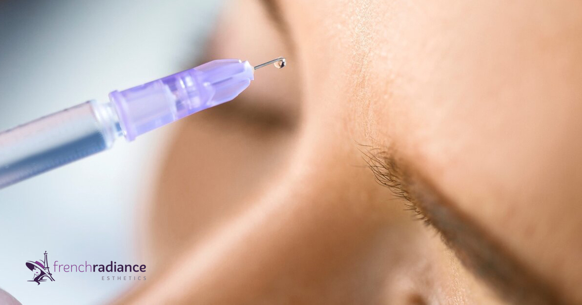 The Migraine-Botox Connection: Relief from the Pain of Migraines